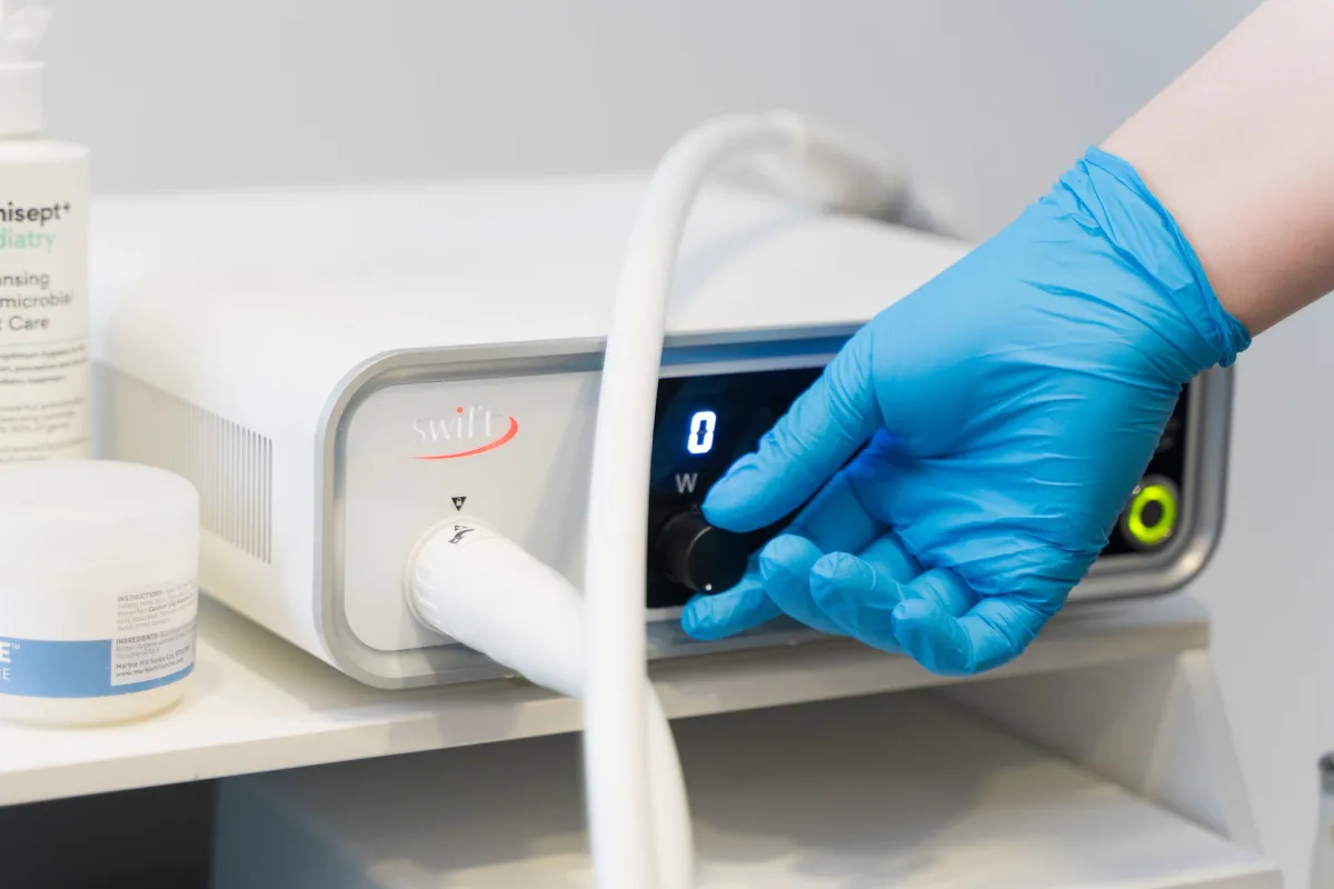 Swift microwave therapy machine used for verruca treatment